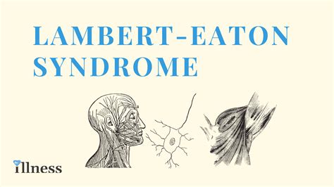 Lambert-Eaton Syndrome : Overview, Causes, Symptoms, Treatment ...