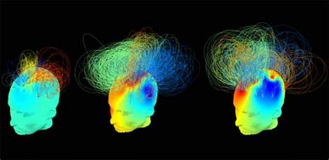 Brain, body and mind: understanding consciousness | University of Cambridge