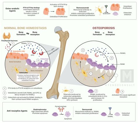 Mnemonic for drugs causing osteoporosis - My Endo Consult