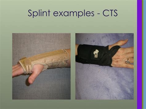 A Flutist's Guide to Carpal Tunnel Syndrome - Flute Specialists