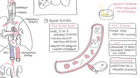 PART II - Pneumonia (Transmission, Causative Agents, Investigations ...