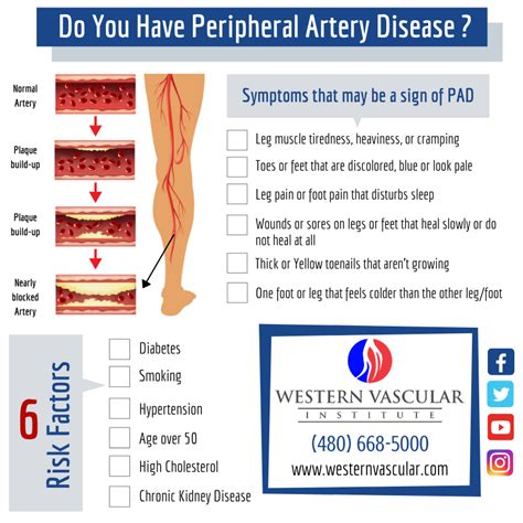 Peripheral Vascular Disease Treatment in Phoenix, Arizona