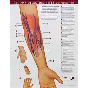 Helpful venipuncture sites | Hematology | Pinterest