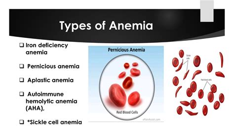 Polycythemia vera hemoglobin levels: Polycythemia Vera Presenting With ...