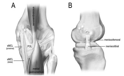 MCL sprains – Symptoms, treatment, and recovery time