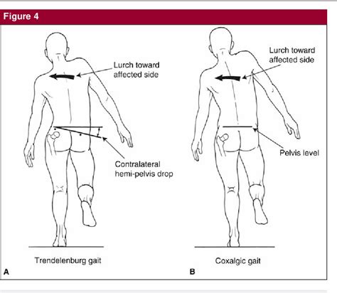 Evaluation of the Elderly Patient With an Abnormal Gait | Semantic Scholar