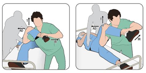 Hip Dislocation | Emergency Medicine Education | Resus