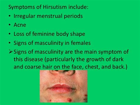 Hirsutism - Symptoms, Causes & Treatment - Santripty