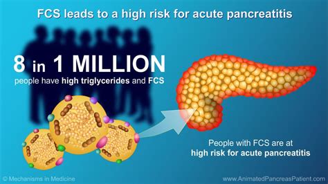 Pin on Animated Pancreas Patient