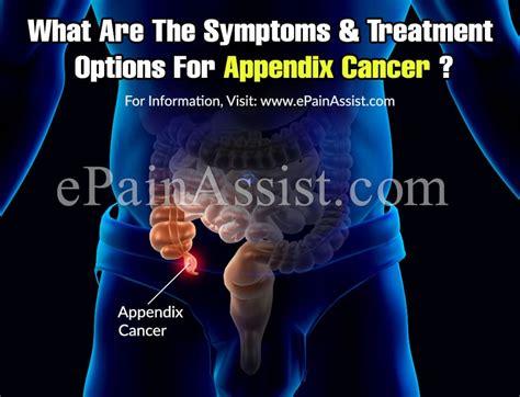 What Are The Symptoms And Treatment Options For Appendix Cancer?