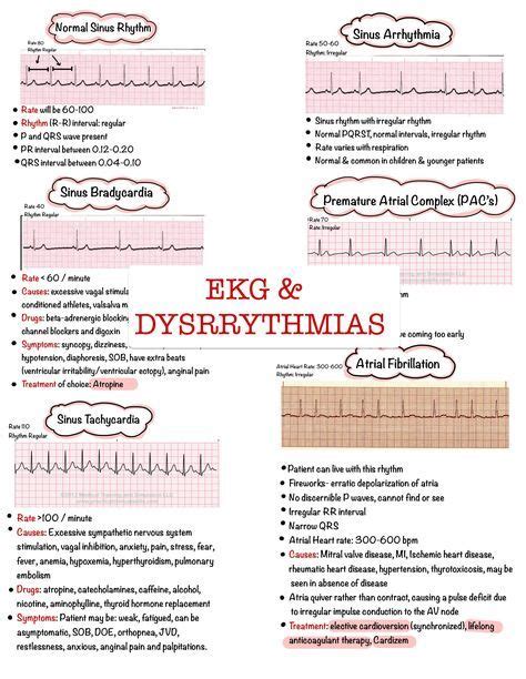 Basic EKG Dysrhythmias & Interpretation Nursing Notes 6 PAGES Digital ...