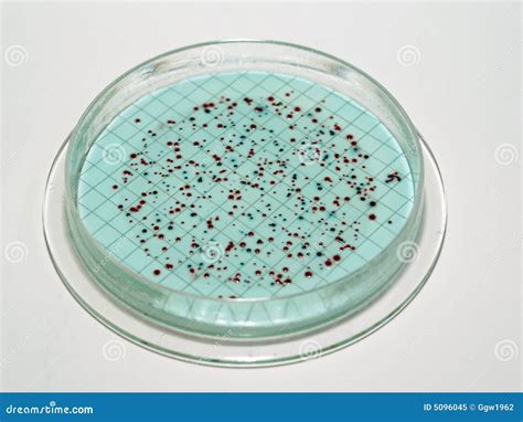 Bacterial colonies stock image. Image of bacteria, microorganism - 5096045