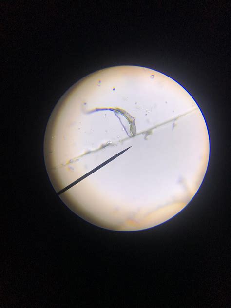 Hi! I’m new to using a microscope. I found this in my fish tank, but ...