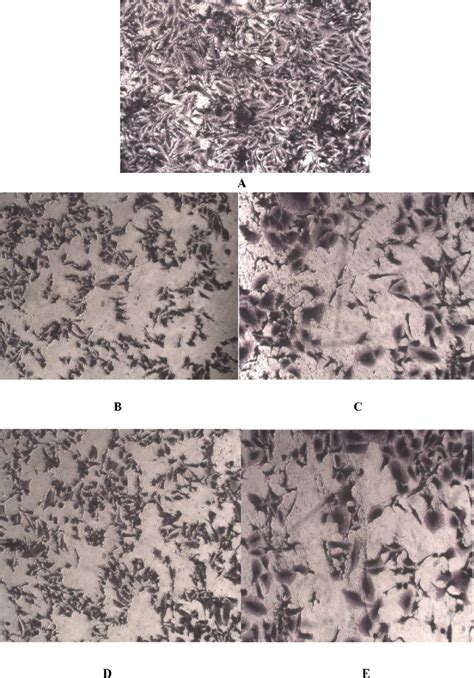 A -Morphological of untreated MCF-7 cells B-Morphological changes in ...