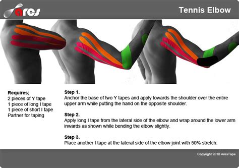 KT Tape helps to treat tennis elbow by increasing circulation to a ...