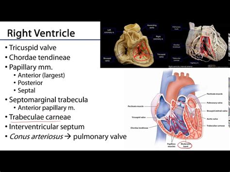 Trabeculae Carneae Vs Papillary Muscle