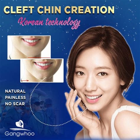 Natural Cleft Chin Creation – For A Charismatic Look - Gangwhoo Cosmetic Hospital - The Top ...