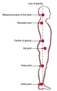 Loss of cervical lordosis depends on teeth