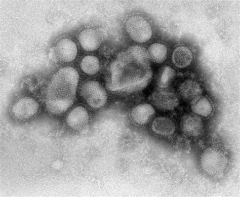 CDC H1N1 Flu | Images of the H1N1 Influenza Virus