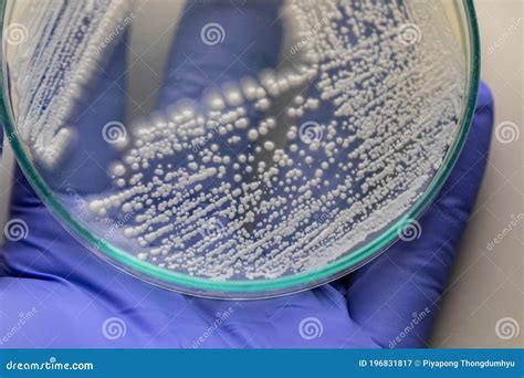 Yeast in Petri Dish for Education in Laboratories. Stock Image - Image ...