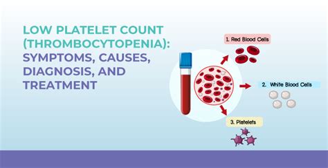 Low Platelet Count (Thrombocytopenia): Symptoms, Causes, Diagnosis, and ...