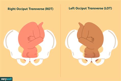 Fetal Positions for Labor and Birth