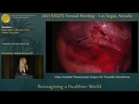 Video-Assisted Thoracoscopic Surgery for Traumatic Hemothorax - YouTube