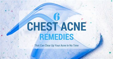 6 Super Effective Remedies That Can Clear Up Your Chest Acne In No Time