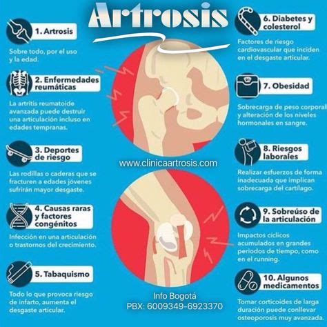 La Artrosis es un síndrome como consecuencia de un conjunto de ...