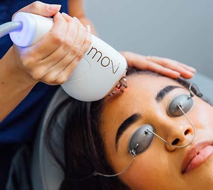 I Tried The Moxi™ Laser: What You Need To Know