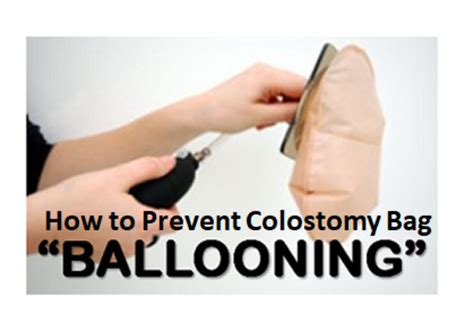 How I Prevent Colostomy Bag Ballooning | Patient's Lounge