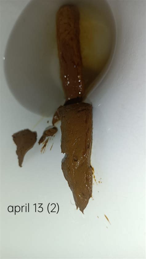 is this somehow internal hemorrhoids? or some kind of ibd? : r/poop