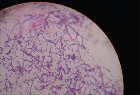 Gram staining - Streptococcus mutans | Download Scientific Diagram