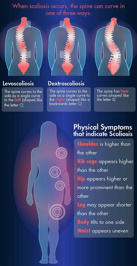 Pin on Spine Health