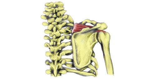 Supraspinatus Tear - Symptoms, Causes, Treatment & Rehabilitation