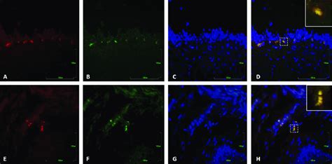 Neural precursor cells remained in an immature state at the injection... | Download Scientific ...