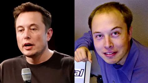 Elon Musk Body Transformation: From Natural Beauty to Plastic Perfection!