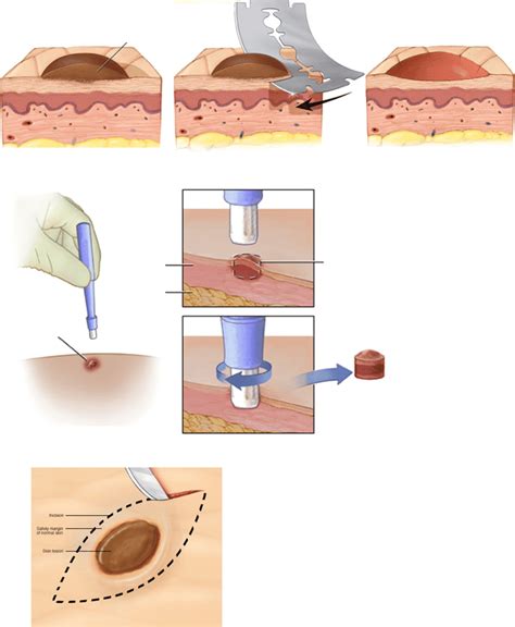 LABORATORIO DE INMUNOHISTOQUÍMICA