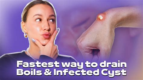 DRAIN BOILS, ABSCESS & INFECTED CYSTS - FAST! - YouTube