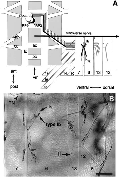 The cell body locations, muscle targets, and axonal pathways of RP... | Download Scientific Diagram