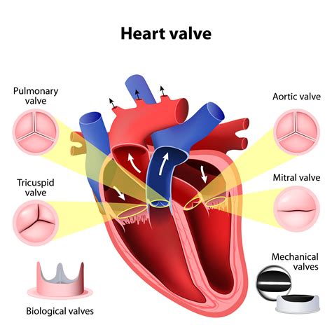 Mechanical heart valves | Heart Surgery Information