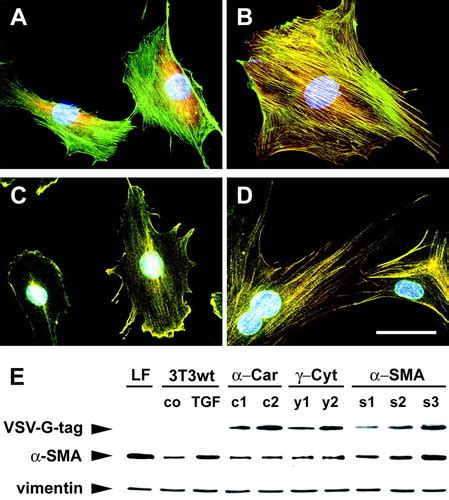 Alpha-Smooth Muscle Actin Expression Upregulates Fibroblast Contractile ...