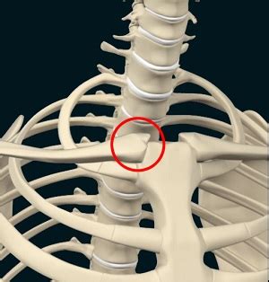 Sternoclavicular Joint Injury Birmingham, AL | SC Joint Injury ...