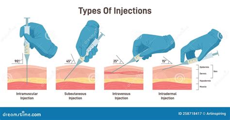 Intradermal Injection. Effective Methods Of Administration Of Drugs And ...