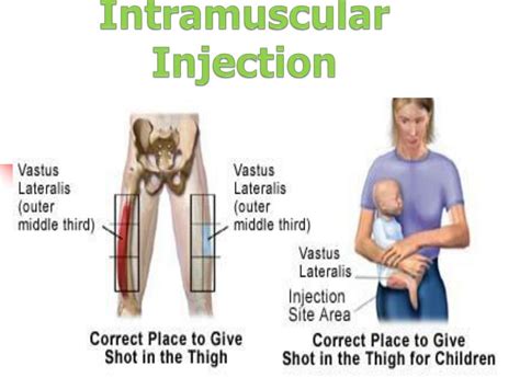 PPT - Administration of Medications in Pediatrics PowerPoint ...