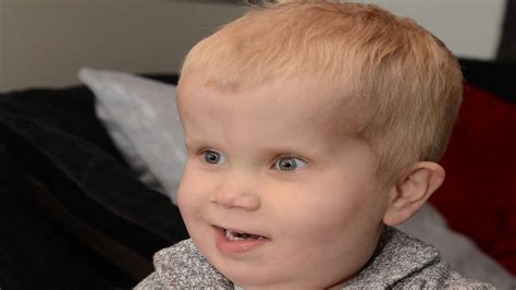 Rio Newman, 3, of Kennington, Ashford, diagnosed with rare growth condition macrocephaly ...