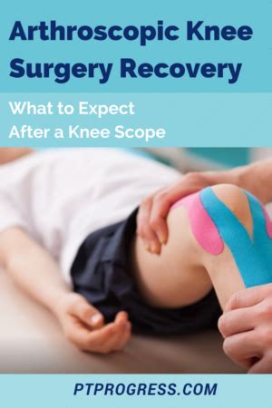 Arthroscopic Knee Surgery Recovery: What to Expect After a Knee Scope