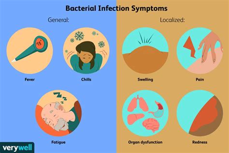 Bacterial Infections: Symptoms, Causes, Diagnosis, and Treatment