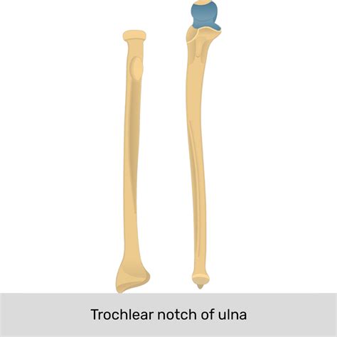 Ulnar Notch Of Radius