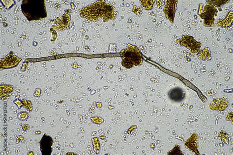 soil fungi and microorganisms in a soil and compost sample Stock Photo ...